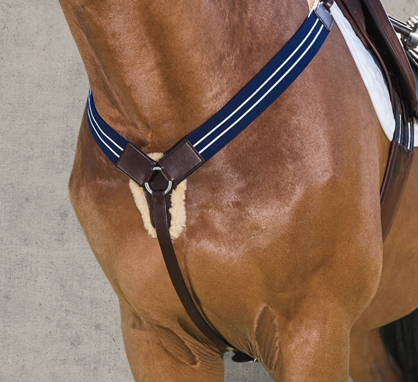 ERS Ovation® Elastic Breastplate